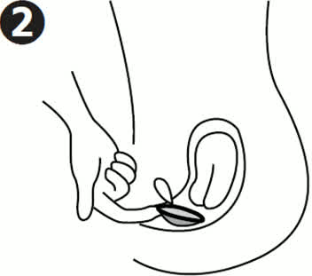 月経ディスクを膣口へ挿入する手順