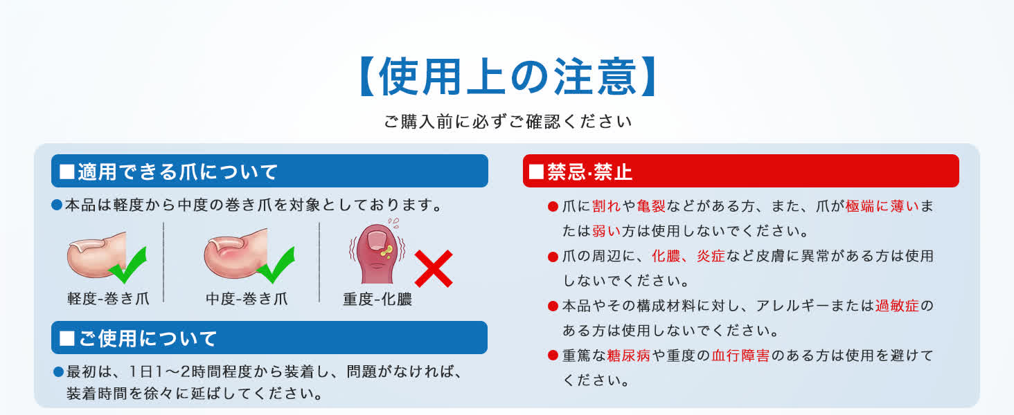 巻き爪矯正器具の適用できる爪と使用上の注意