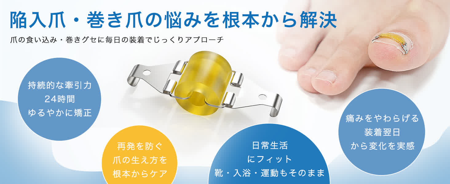 陥入爪・巻き爪の悩みを毎日の装着で根本からケアする巻き爪矯正器具
