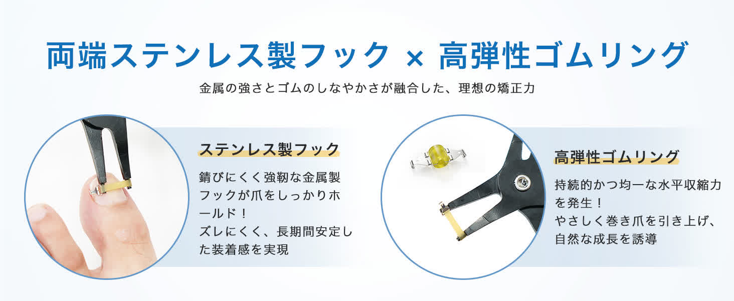 巻き爪や陥入爪による痛み・見た目・再発不安などのお悩み